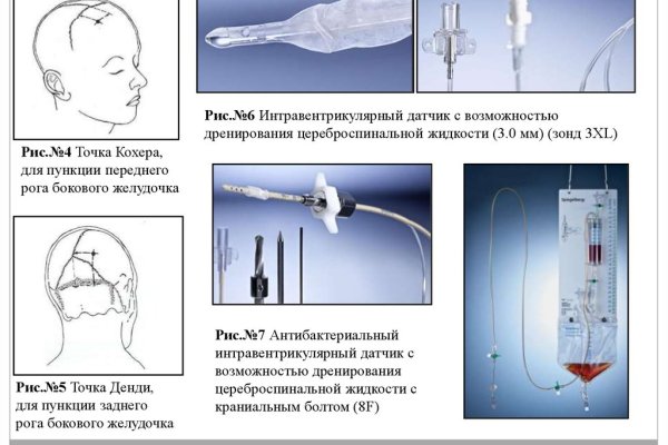 Кракен наркоз магазин